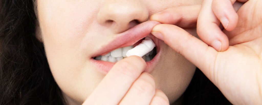 Nicotine pouch used discreetly under the upper lip